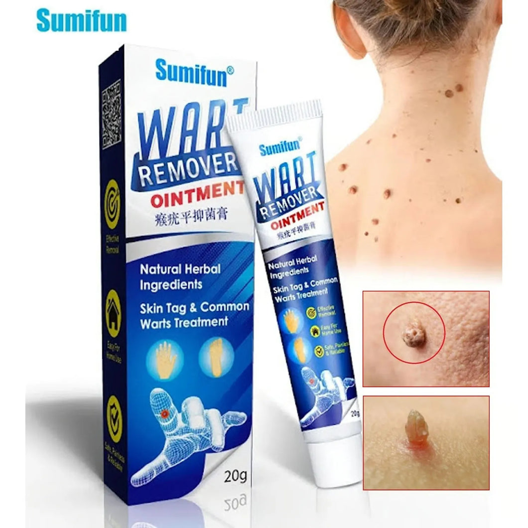 WART REMOVER - REMOVEDOR DE VERRUGAS 100% ORIGINAL